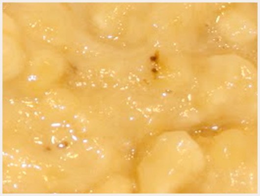 Banane Ananas