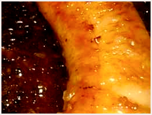 Banane Antillaise