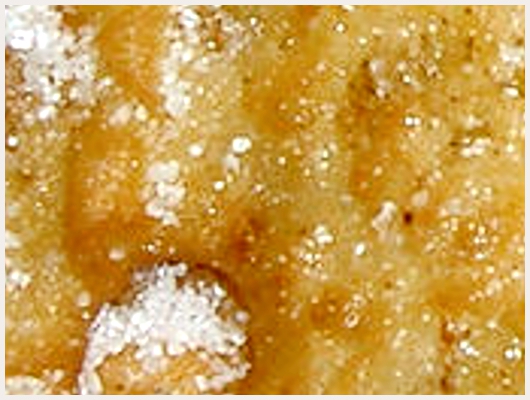 Beignet Ananas