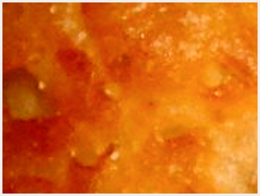Beignet Banane Facile