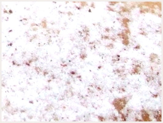 Beignet Levure Chimique