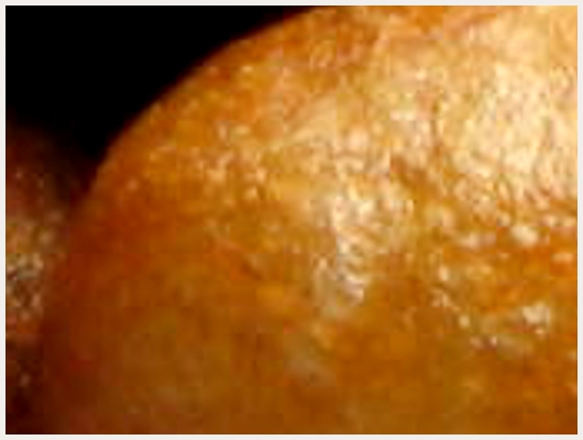 Beignet Rond