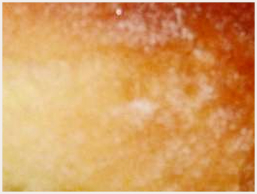 Beignet Sans Friture