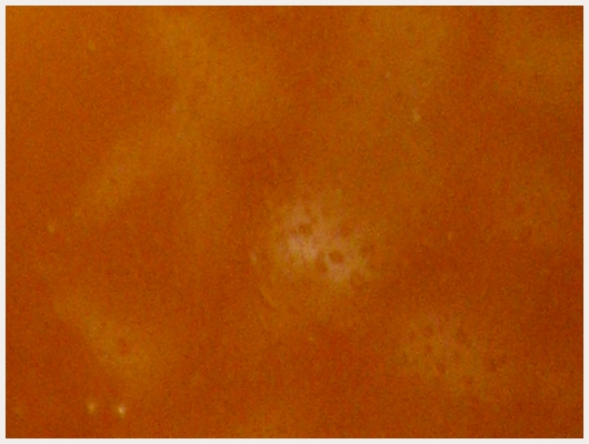 Caramel Fondu