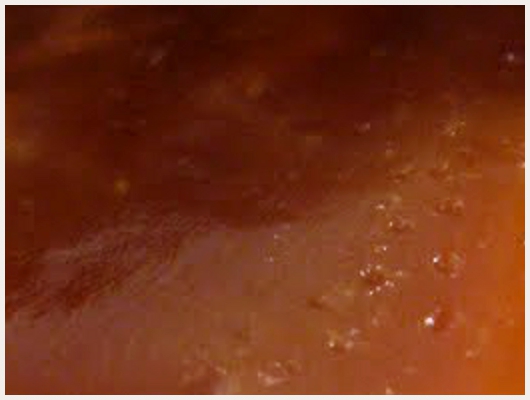 Caramel qui Durcit