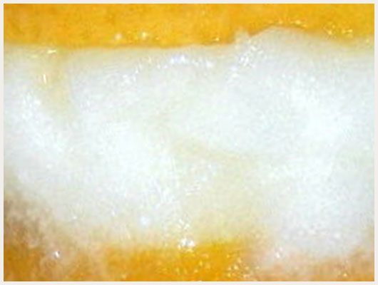 Citron Givré
