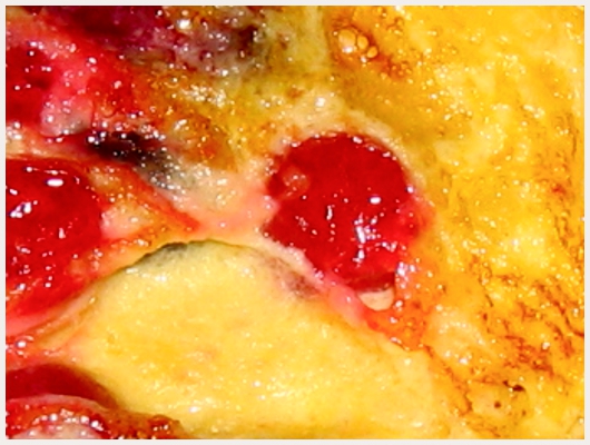 Clafoutis Groseilles