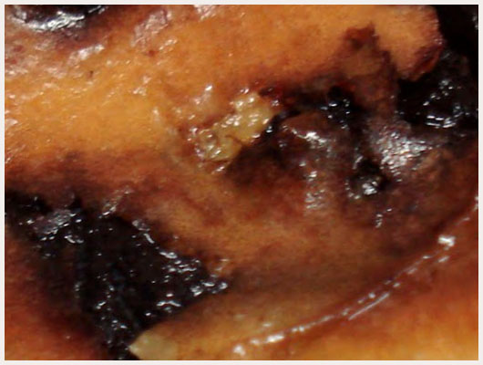 Far breton aux raisins secs