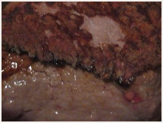 Filet d'Autruche Foie Gras