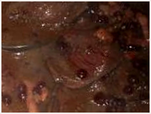 Filet de Biche aux Griottes