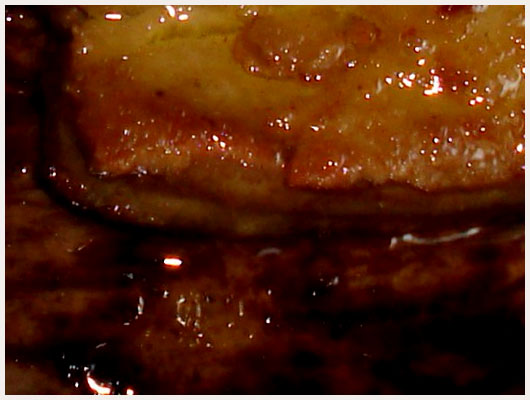 Filet de Boeuf au Foie Gras Poel