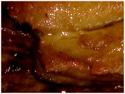 Filet de Boeuf au Foie Gras