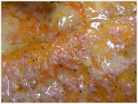 Foie de Veau à la Lyonnaise