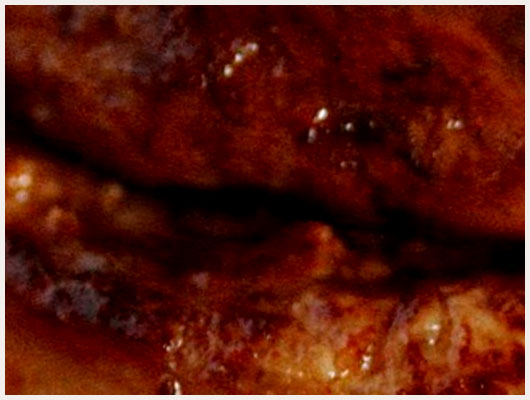 Foie de Veau aux Coings