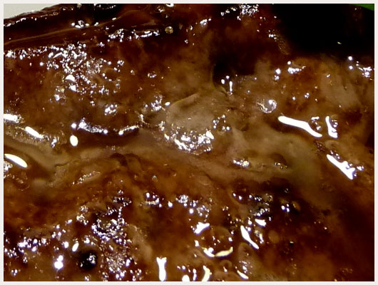 Foie de Veau Vinaigre