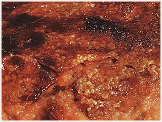 Gateau de riz au chocolat