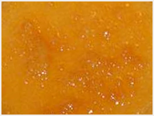 Gateau de semoule