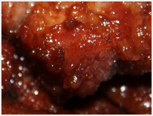 Porc Laqué Barbecue