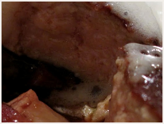 Ris de Veau au Foie Gras
