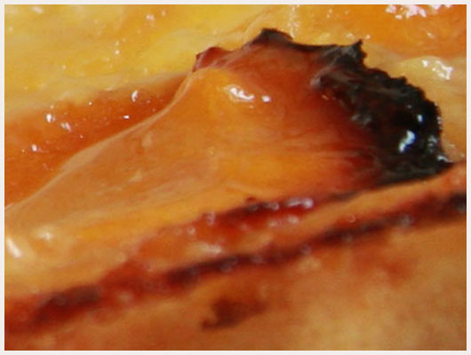 Tarte aux abricots amande