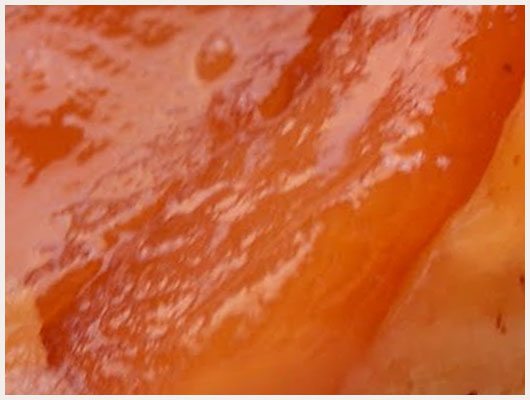 Tarte tatin facile