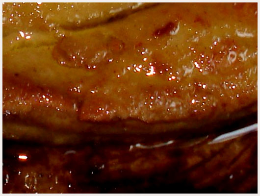 Tournedos d'Autruche Airelles