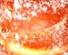 Beignet Farine