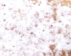 Beignet Levure Chimique