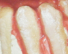 Charlotte aux Fraises et Framboises