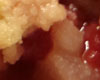 Crumble Framboise Pomme