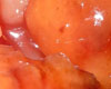 Porc  l'Ananas Chinois